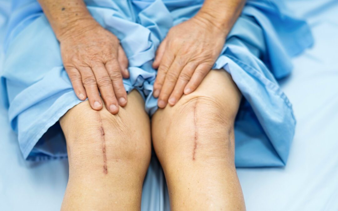 Could Scar Tissue Be Contributing To Your Pain?